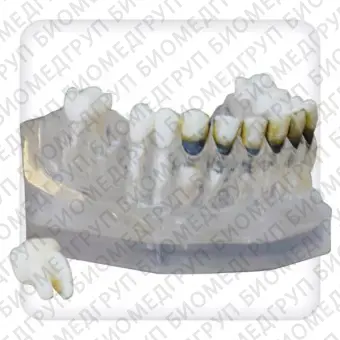 Модель верхней и нижней челюстей с 28 модельными зубами для лечения пародонтоза