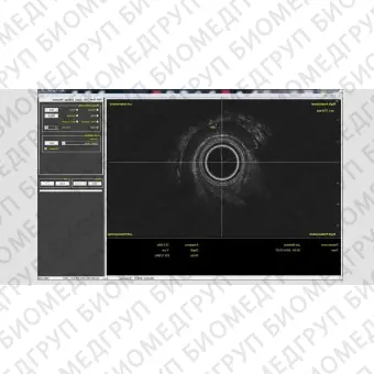 Ультразвуковой сканер на платформе, компактный Morpheus 360