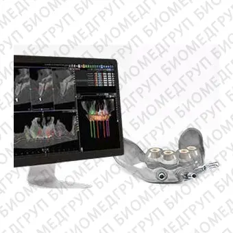 Программное обеспечение для управляемой хирургии Implant3D