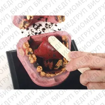 Анатомическая модель прорезывание зубов 79152