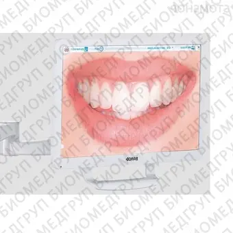 S380 TRC Continental  стоматологическая установка с нижней подачей инструментов