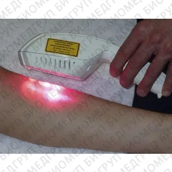 Лазер для фотостимуляции в ортопедии PHYSIOLASER OLYMPIC