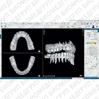 Программное обеспечение для обработки снимков зубов NemoCast
