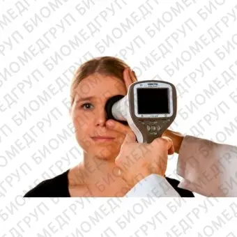 Optomed Smartscope M5 Фундускамера