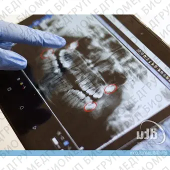 Планшетный медицинский ПК для обработки снимков зубов Smart View
