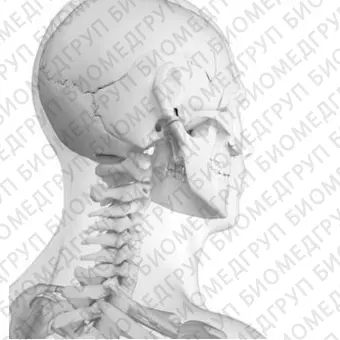 Слуховой имплантат с костной проводимостью внутренняя часть BCI 602
