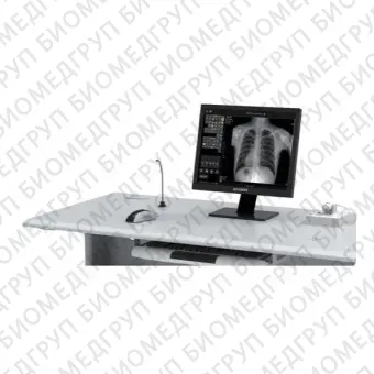 Система рентгеноскопии PLD6000