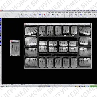 Программное обеспечение для обработки снимков зубов XrayVision