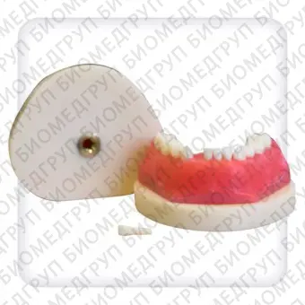 Модель верхней и нижней челюстей с 24 интактными зубами сменного прикуса