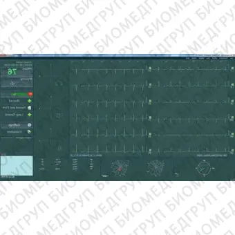 Электрокардиограф для спокойного состояния BTL CardioPointECG C600