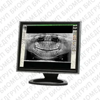 Программное обеспечение для обработки снимков зубов Visix