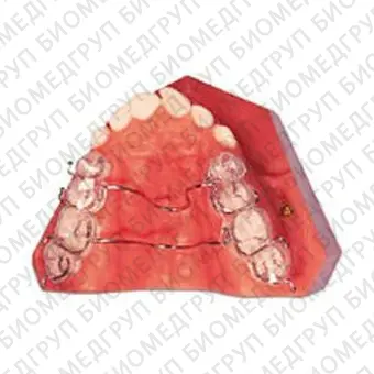 Комплект инструментов для ортодонтии VectorTAS 