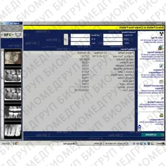 Программное обеспечение для обработки снимков зубов XrayVision