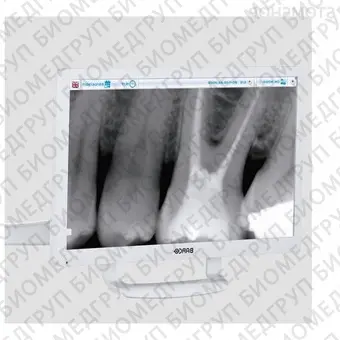 S220 TR International  стоматологическая установка с нижней подачей инструментов