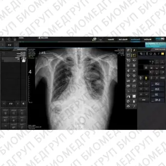 Redikom Рентгенодиагностическая система