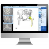 Программное обеспечение TDM ZedHip 3D