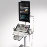 Ультразвуковой сканер переносной, с тележкой ALBIT MSK