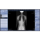 Программное обеспечение для медицинских снимков Xmaru PACS