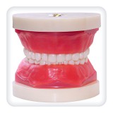 Анатомическая модель прорезывание зубов CM0011
