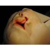Медицинский симулятор для операции при расщелине губы LIP