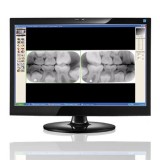 Программное обеспечение для обработки снимков зубов Visix®