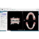 Программное обеспечение для обработки снимков зубов NemoCast