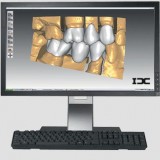 Программное обеспечение для стоматологии IDC D1