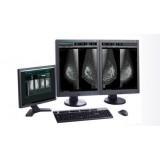 Информационная рабочая станция для маммографии ASPIRE Bellus II