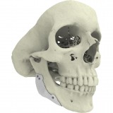 Челюстной имплантат на заказ CT-Bone®