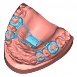 Программное обеспечение для стоматологических лабoраторий APPLIANCE