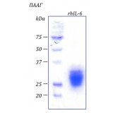 Интерлейкин 6 человека, рекомбинантный белок, rhIL-6, Россия, PSG180-100, 100 мкг
