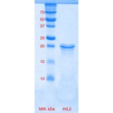 Интерлейкин 2 человека, рекомбинантный белок, rhIL-2, Россия, PSG210-10, 10 мкг