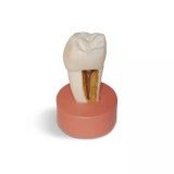 DM26 увеличенная модель зуба со вкладкой для демонстрации, высота 9 см.