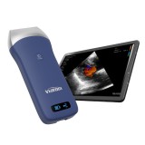 Портативный ультразвуковой сканер Viatom